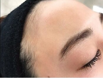 トゥイーディア(Tweedia)の写真/【NEW★フェイシャルWax】肌に優しいWaxでお顔の産毛を除去し、鎮静クリームでお仕上げ！メイクノリ抜群♪