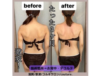 クチュール(couture.)/産後3か月で