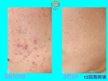 リュクス(LUXE)/ビフォーアフター