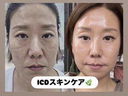 ラヴィ(Ravi)の写真