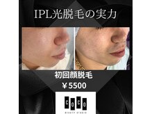 ココ(COCO)の雰囲気（男性の美肌に脱毛がマストです！）