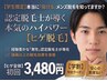 【学割U24】メンズ脱毛(ヒゲ全体)都度払い初回¥3480 約30分