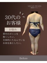 レディラック 大阪梅田本店(Lady Luck)/キャビテーションコース
