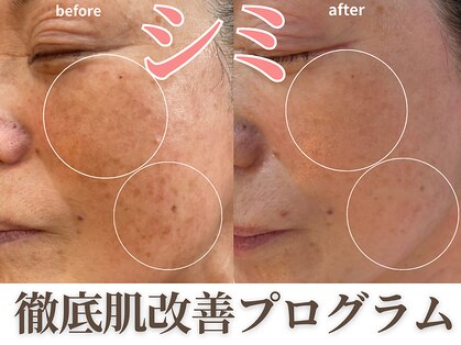 シーズ(C’s)の写真