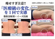 イーズスリミングプロ 横浜コレットマーレ店