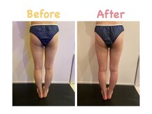 クレビア 麻布十番(CREBIA)/短期間で下半身スッキリ！！