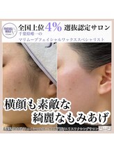 エリス(ELISSE)/脱マスクで横顔美人