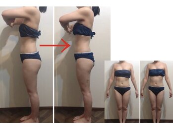 ピアリーノ(Pialino)/28歳　３ヶ月