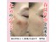 アフェクションビューティー(affection beauty.)の写真