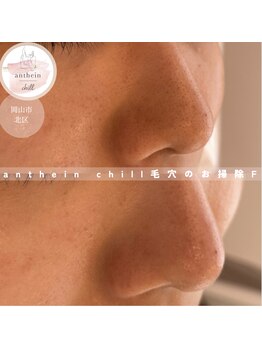 アンテイン チル(anthein chill)/毛穴のお掃除フェイシャル