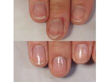 ミュゲネイルズ(muguet nails)の雰囲気（最強のネイルケア、深爪改善、お気軽にお問い合わせ下さい★）