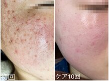 ラブリボン/短期プログラム