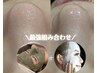 【毛穴、黒ずみ、頬の毛穴開き解消！】ハーブ×高濃度炭酸パック¥17600