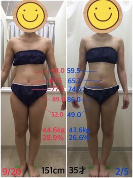 エスティフル 狭山店(ESTIFUL)/[痩身エステ]Before/After