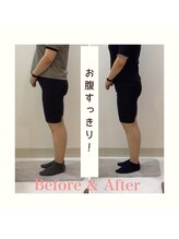スタイルラボ高松/産後の骨盤矯正の効果♪