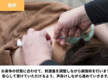 名古屋鍼灸 美容健康院/施術