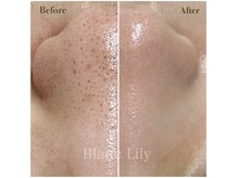 ブランリリー(Blanc Lily)の雰囲気(症例数多数有り◎ニキビ、毛穴、シミ、乾燥あらゆる肌悩みに)