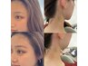 【女性/新規限定】垢抜け美人セット！うなじWAX＋美眉HBL 9,900円→9,000円