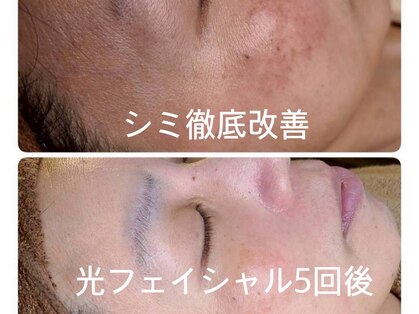 ウェルビーイング(well-being)の写真