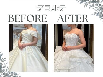 ボディキュア ブライダル美容整体 大阪梅田の写真/【自分史上最高に美しい自分へ♪】美しく健康的な身体を手に入れたい！それ、ボディキュアにお任せ下さい◎