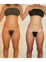 ビューティースパ/パンツがスーッと履ける♪