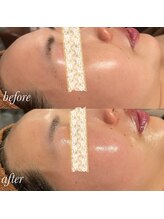 マージェ(magie)/【ヒト幹細胞美容液】使用