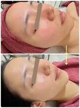 リファイン(REFINE)/国産ハーブで艶めく！！