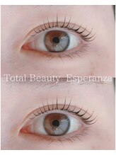 エスペランサ(Esperanza)/