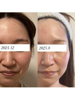 ひっそり美肌構築/スペシャルカスタマイズメニュー