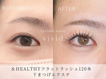 ビビッド(vivid)/パリエク進化版【&Healthy】