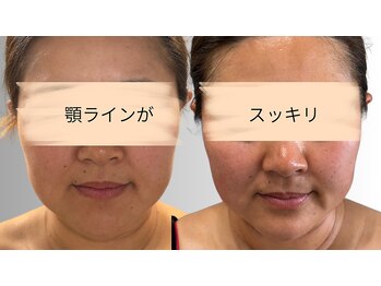 リズ(rE:S)/韓国肌管理-bitmuse salon- rE:S