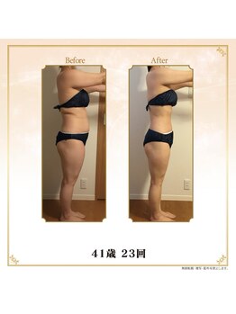 ベルシア 吉祥寺店(BELCIA)/