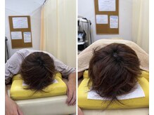 CA鍼灸整骨院の雰囲気（施術後はお悩みがなくなるよう結果にこだわってます）