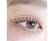 アイサプリメント(eye supplement)の写真