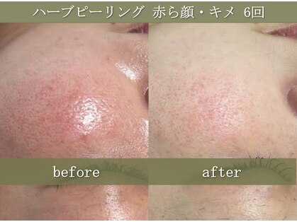 椿(TSUBAKI)の写真