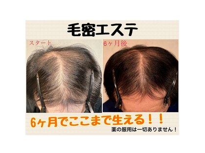サロンチョコ(salon choco)の写真