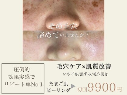 エステの森ジュジュの写真