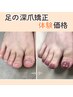 【深爪/噛み爪/むしり爪】即日見た目改善！フット深爪矯正体験