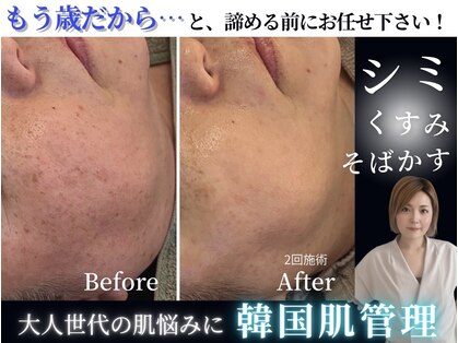 センシズ(Senses)の写真