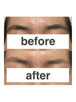 ルナレーナ化粧品 西鉄グランドホテル店/お客様と確認しながら