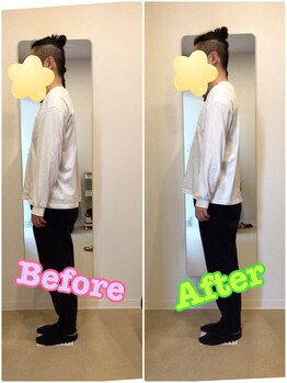 うちんだい整骨院 整体院/30代男性/猫背矯正 施術事例