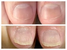 グレースレディ/爪をむしるスキなし！