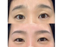 ネージュ(Neige)の雰囲気（劇的ビフォーアフター！！困り眉卒業☆）