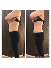 リム ビューティー(RYM BEAUTY)/最新超音波×インディバ