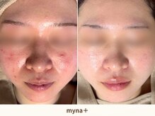 マイナプラ 表参道(myna+)/