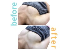 シエル(Ciel)/バストアップ施術１回