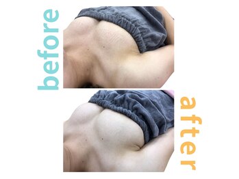 シエル(Ciel)/バストアップ施術１回