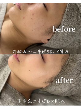 紬/before・after