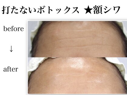 Nビューティーの写真