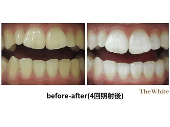 【ホワイトニング専門サロン】The White【10/10 NEW OPEN(予定)】の写真/【綾瀬ホワイトニング専門店】予約が取りやすい１０月NewOpenホワイトニングサロン☆リーズナブルな価格☆